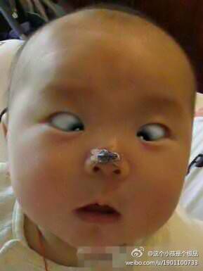 儿童爆笑表情之标志斗鸡眼