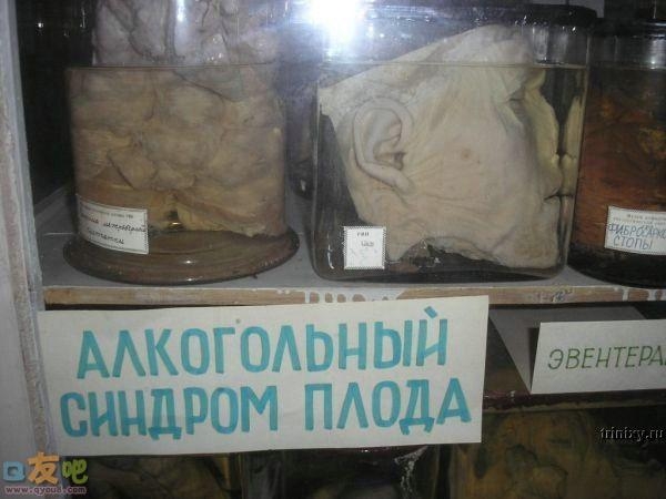 恐怖的人体标本图片