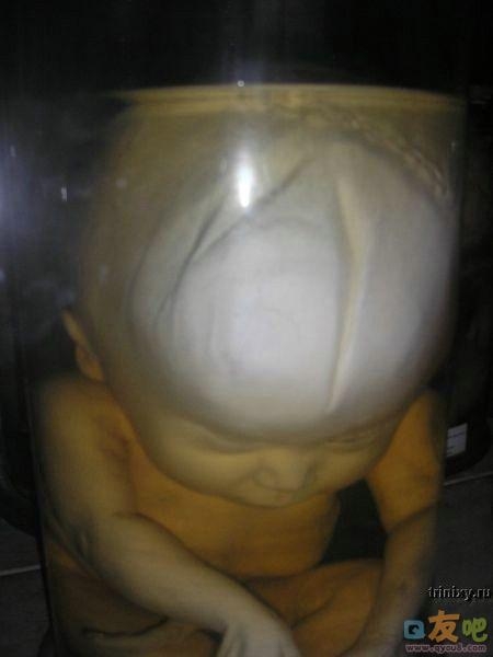 恐怖的人体标本图片