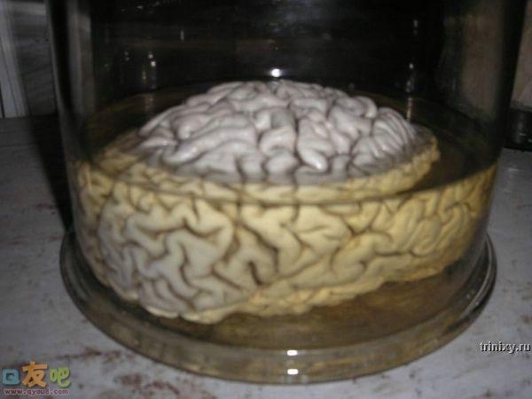 恐怖的人体标本图片