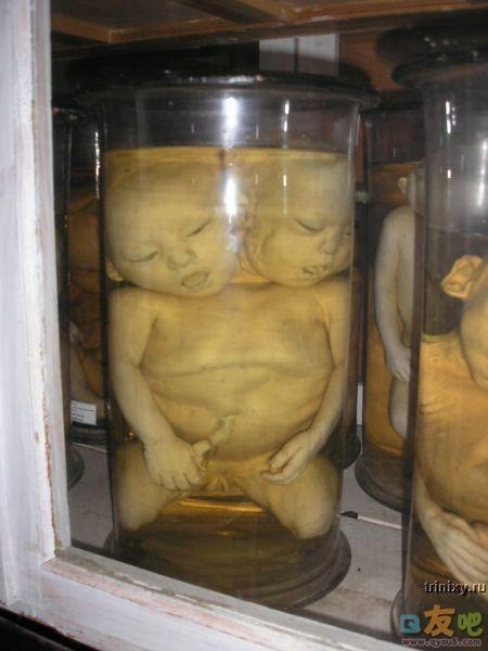 恐怖的人体标本图片