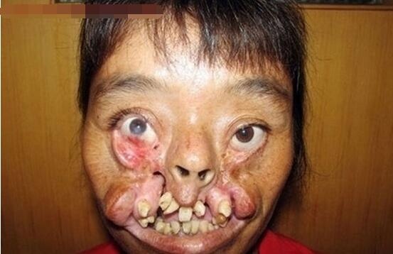 恶心图片吓死人不偿命