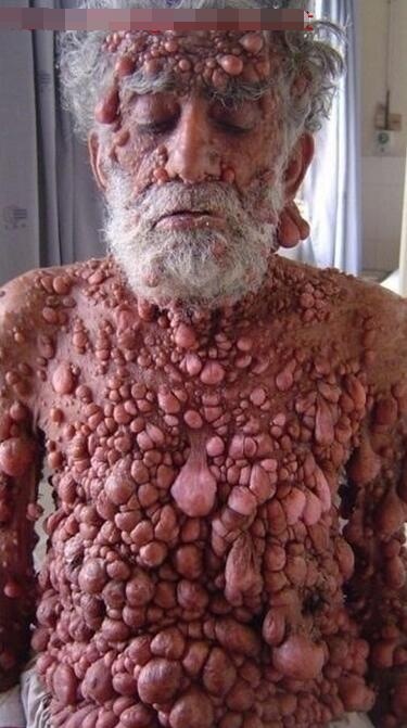 恶心图片吓死人不偿命