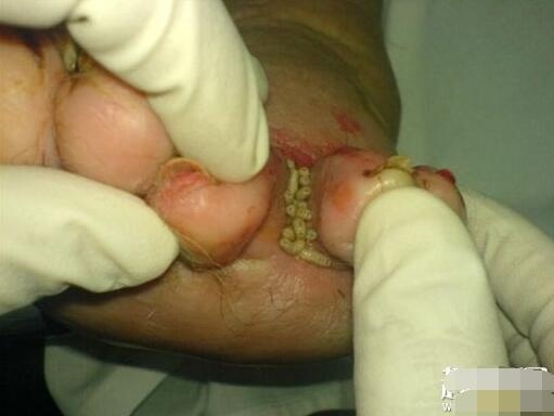 恶心图片吓死人不偿命