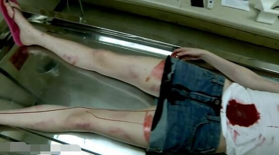 女尸体解剖图片