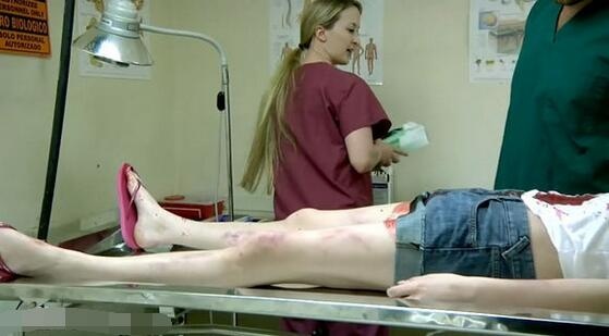 女尸体解剖图片