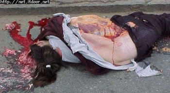 街头尸体死无其所