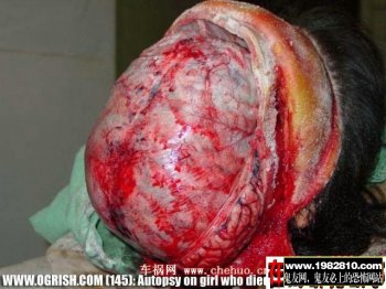 锯开脑盖后的大脑结构实图