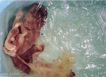 吃死婴行为艺术图片