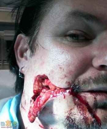 皮开肉绽的恐怖图片