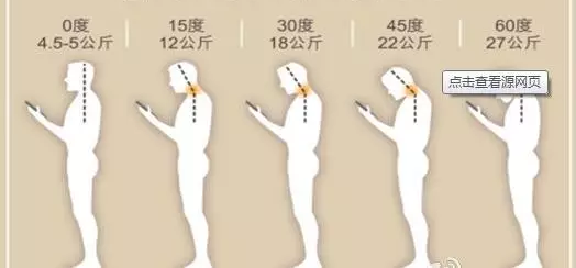 男子伸了个懒腰就高位瘫痪 医生:这类人容易中招