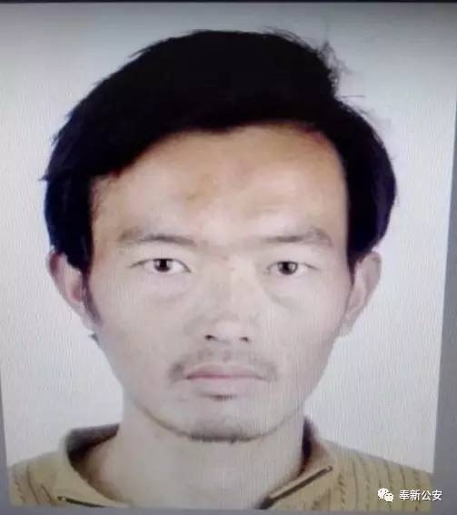 “江西11岁女孩双手被砍断”续：现已接上 手指能动