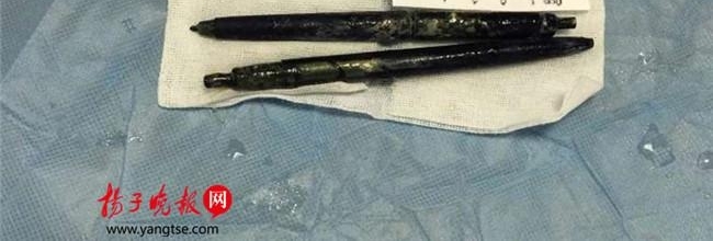 圆珠笔吞进体内36年后取出 竟是因为跟朋友喝酒打赌