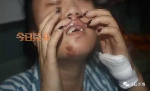 95后嫩模酒驾撞三人:1死2伤 现场豪车曝光