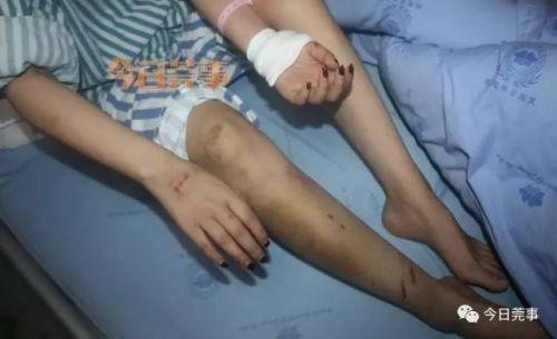 95后嫩模酒驾撞三人:1死2伤 现场豪车曝光