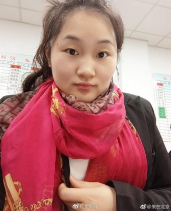 22岁女子称被性侵后与施暴者恋爱 同居被打成重伤