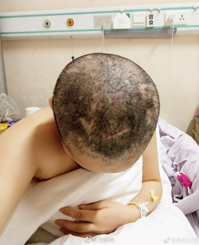 22岁女子称被性侵后与施暴者恋爱 同居被打成重伤