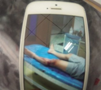 “表弟”QQ发来一张受伤照片 重庆小伙被骗1000元