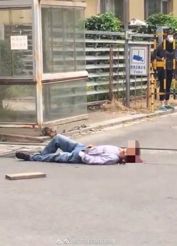 北京一路人被木板砸中头部 颅脑损伤正在抢救