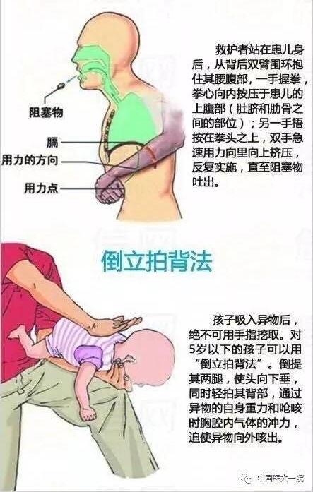 惊险！皮皮虾前腿扎进气管…