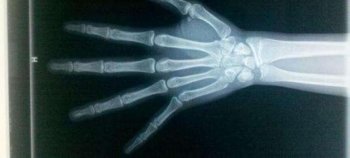 800元就能解决儿子的事情 男子却要花费十几万