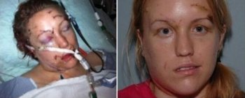 美女被捅32刀差点没命，被医生救活后“以身相许”