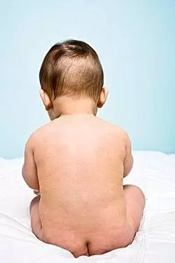 罕见！ 新生宝宝明明长着“小鸡鸡” 医生却说是女孩