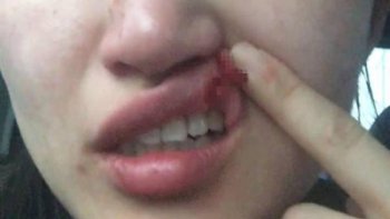 滴滴司机被指暴打女乘客致唇部缝9针 警方：已立案