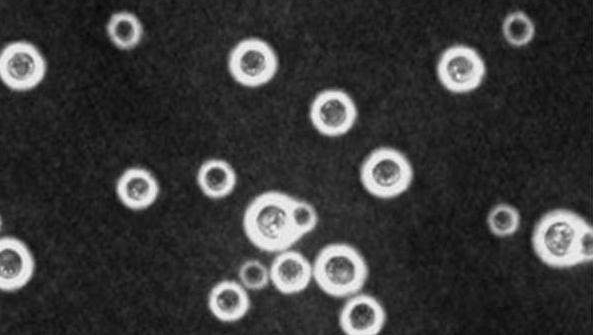 男子离家三个月后，一进屋子瞬间傻眼了，每个家庭都要小心防范！