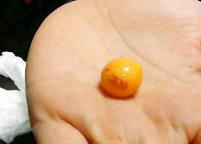 椰子螺吐出10万美乐珠 老板娘乐翻直呼好运