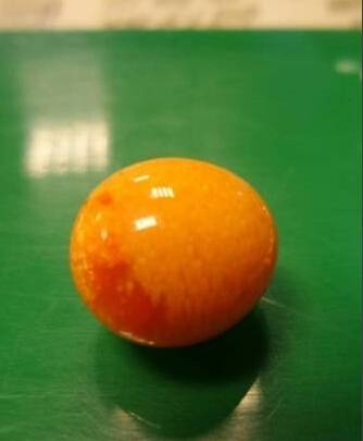 椰子螺吐出10万美乐珠 老板娘乐翻直呼好运